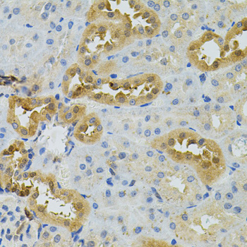 Immunohistochemistry - NAT8 Polyclonal Antibody 