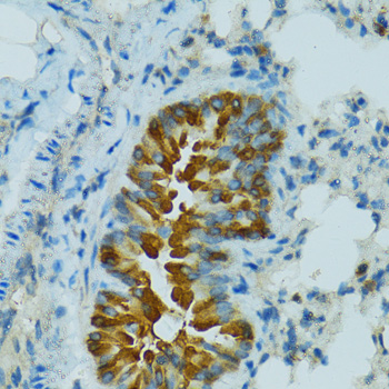 Immunohistochemistry - CYP2B6 Polyclonal Antibody 