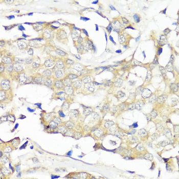 Immunohistochemistry - EIF3B Polyclonal Antibody 