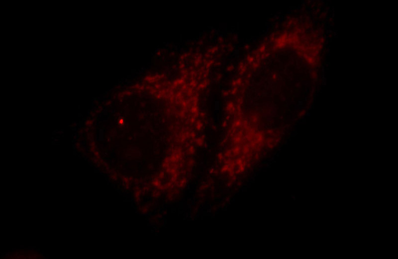 Immunofluorescent analysis of HepG2 cells, using TIMM9 antibody Catalog No:116136 at 1:25 dilution and Rhodamine-labeled goat anti-rabbit IgG (red).