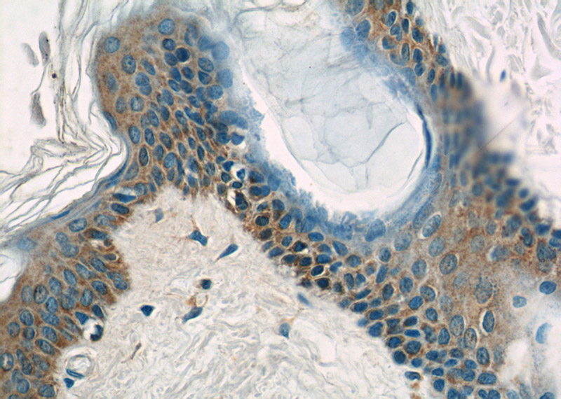 Immunohistochemistry of paraffin-embedded human skin tissue slide using Catalog No:110416(EXPH5 Antibody) at dilution of 1:50 (under 40x lens)