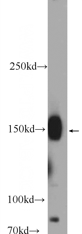 mouse brain tissue were subjected to SDS PAGE followed by western blot with Catalog No:113692(PCDH9 Antibody) at dilution of 1:600