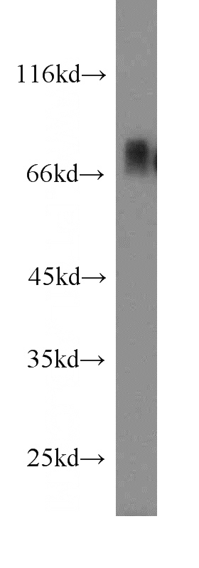 NIH/3T3 cells were subjected to SDS PAGE followed by western blot with Catalog No:109876(DBF4 antibody) at dilution of 1:300