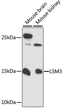 Western blot - LSM3 Polyclonal Antibody 