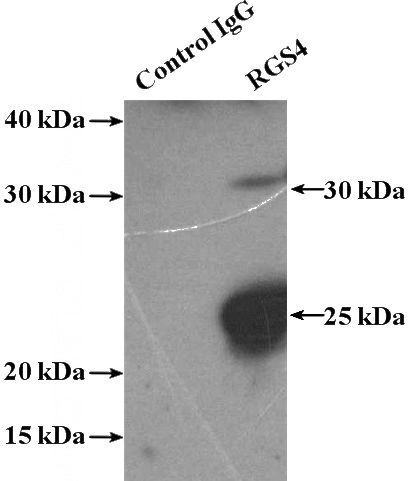 IP Result of anti-RGS4 (IP:Catalog No:114647, 4ug; Detection:Catalog No:114647 1:300) with mouse brain tissue lysate 4000ug.