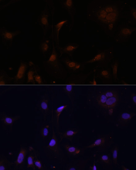 Immunofluorescence - TET3 Polyclonal Antibody 