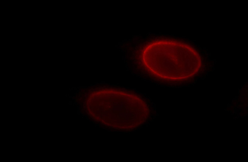 Immunofluorescent analysis of HepG2 cells, using LBR antibody Catalog No:112162 at 1:25 dilution and Rhodamine-labeled goat anti-rabbit IgG (red).