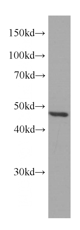 MCF-7 cells were subjected to SDS PAGE followed by western blot with Catalog No:107273(IDH1 Antibody) at dilution of 1:1000