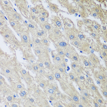 Immunohistochemistry - MLKL Polyclonal Antibody 