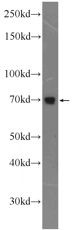 mouse liver tissue were subjected to SDS PAGE followed by western blot with Catalog No:108116(AP1G2 Antibody) at dilution of 1:300