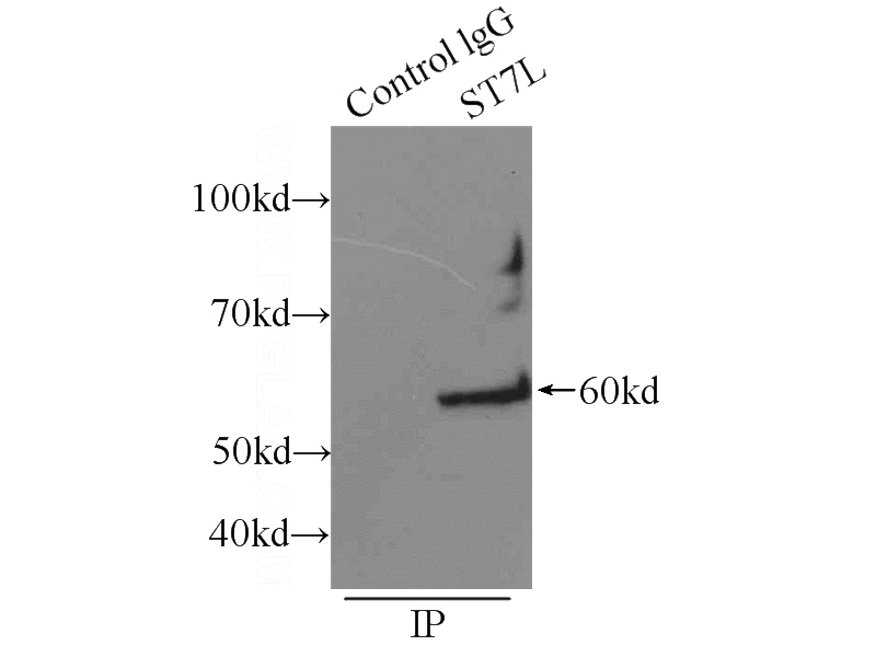 IP Result of anti-ST7L (IP:Catalog No:115632, 3ug; Detection:Catalog No:115632 1:1500) with mouse testis tissue lysate 5000ug.