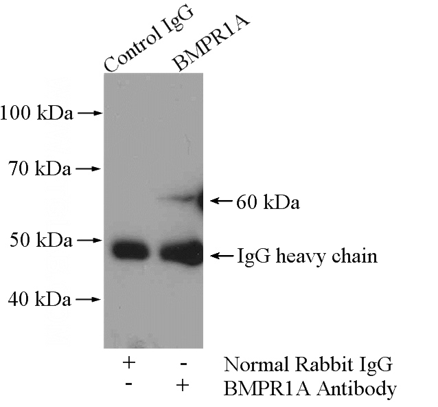 IP Result of anti-BMPR1A (IP:Catalog No:117202, 4ug; Detection:Catalog No:117202 1:500) with HEK-293 cells lysate 2000ug.