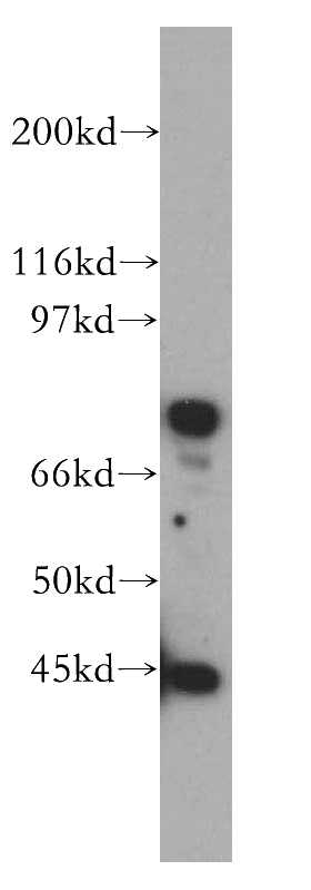 Jurkat cells were subjected to SDS PAGE followed by western blot with Catalog No:111746(IL5RA antibody) at dilution of 1:300