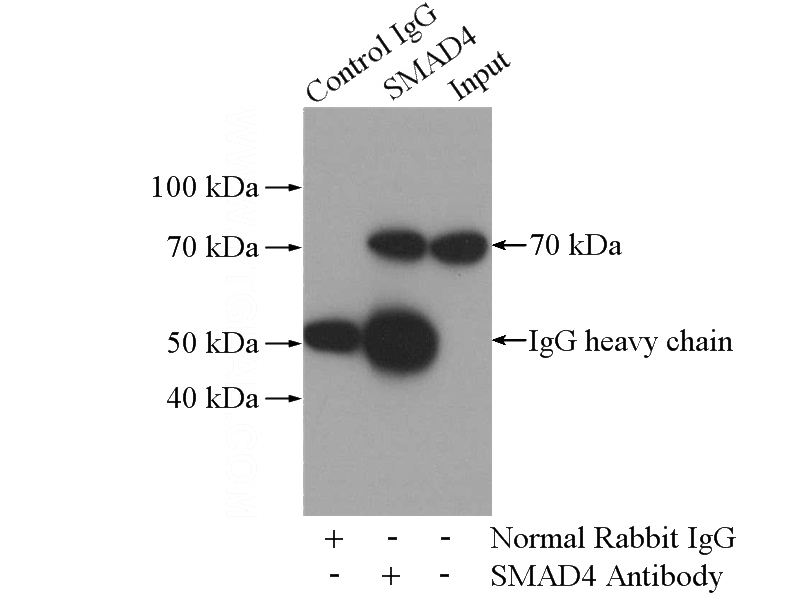 IP Result of anti-SMAD4 (IP:Catalog No:115418, 4ug; Detection:Catalog No:115418 1:600) with mouse liver tissue lysate 4000ug.