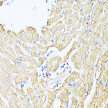 Immunohistochemistry - ALOX12 Polyclonal Antibody 