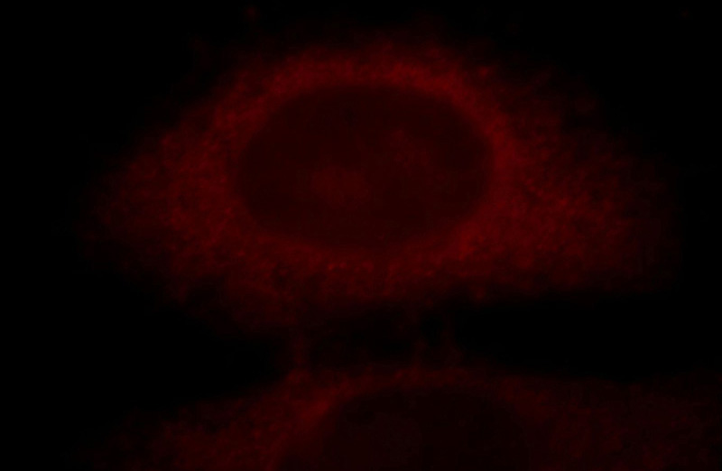 Immunofluorescent analysis of HepG2 cells, using CLN3 antibody Catalog No:109396 at 1:25 dilution and Rhodamine-labeled goat anti-rabbit IgG (red).