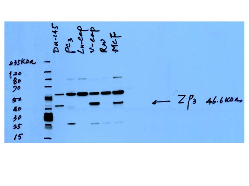 WB result of Catalog No:117262(ZP3) from Dr. Soory. (Target band 41-47kd,56kd(Glycosylated form, PMID:19700799),83kd(PMID: 1577197).