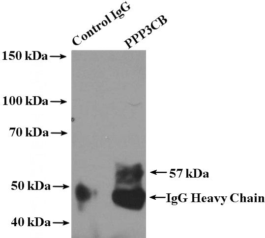 IP Result of anti-PPP3CB (IP:Catalog No:114111, 4ug; Detection:Catalog No:114111 1:500) with mouse brain tissue lysate 4000ug.
