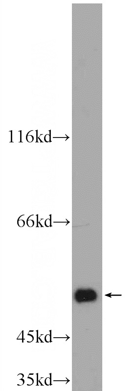 mouse liver tissue were subjected to SDS PAGE followed by western blot with Catalog No:107961(ALDH1A3 Antibody) at dilution of 1:1000