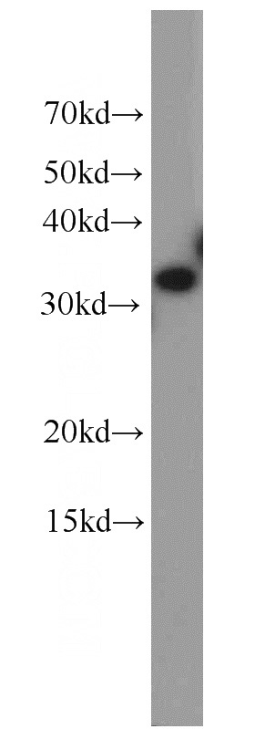 K-562 cells were subjected to SDS PAGE followed by western blot with Catalog No:110378(ESD antibody) at dilution of 1:1200