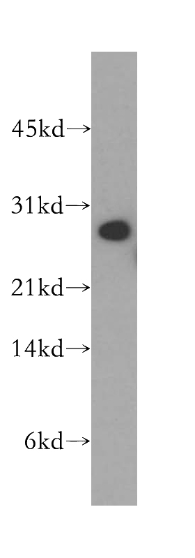 human kidney tissue were subjected to SDS PAGE followed by western blot with Catalog No:115447(SNAP29 antibody) at dilution of 1:500