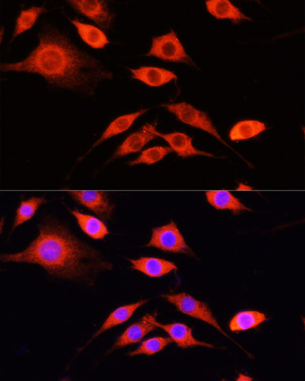 Immunofluorescence - SERPINA10 Polyclonal Antibody 
