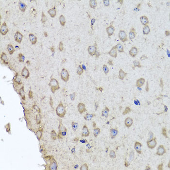 Immunohistochemistry - HBA2 Polyclonal Antibody 