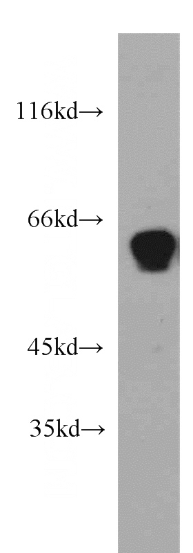 mouse brain tissue were subjected to SDS PAGE followed by western blot with Catalog No:113311(NOVA2 antibody) at dilution of 1:500