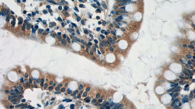 Immunohistochemistry of paraffin-embedded human small intestine tissue slide using Catalog No:109849(DEFA1 Antibody) at dilution of 1:50 (under 40x lens)