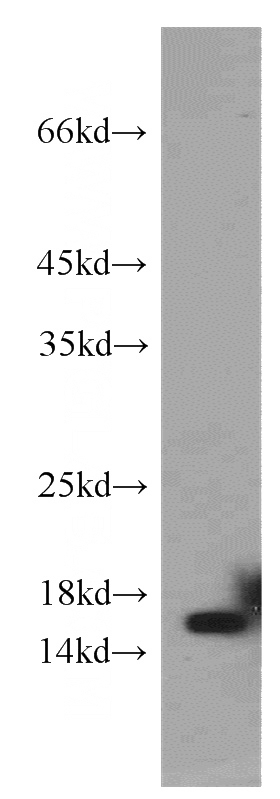 human testis tissue were subjected to SDS PAGE followed by western blot with Catalog No:109611(CST1 antibody) at dilution of 1:300