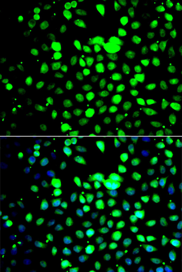 Immunofluorescence - ZBTB25 Polyclonal Antibody 