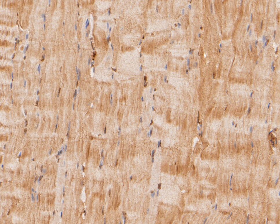 Fig4: Immunohistochemical analysis of paraffin-embedded rat smooth muscle tissue using anti-RBPMS antibody. The section was pre-treated using heat mediated antigen retrieval with sodium citrate buffer (pH 6.0) for 20 minutes. The tissues were blocked in 5% BSA for 30 minutes at room temperature, washed with ddH2O and PBS, and then probed with the primary antibody ( 1/50) for 30 minutes at room temperature. The detection was performed using an HRP conjugated compact polymer system. DAB was used as the chromogen. Tissues were counterstained with hematoxylin and mounted with DPX.