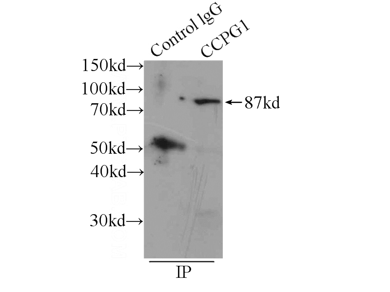 IP Result of anti-CCPG1 (IP:Catalog No:109073, 4ug; Detection:Catalog No:109073 1:500) with mouse brain tissue lysate 6000ug.