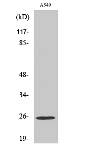 Fig1:; Western Blot analysis of various cells using Rho GDIγ Polyclonal Antibody