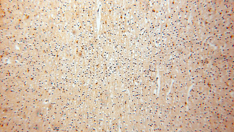 Immunohistochemical of paraffin-embedded human brain using Catalog No:110757(FXYD6 antibody) at dilution of 1:100 (under 10x lens)