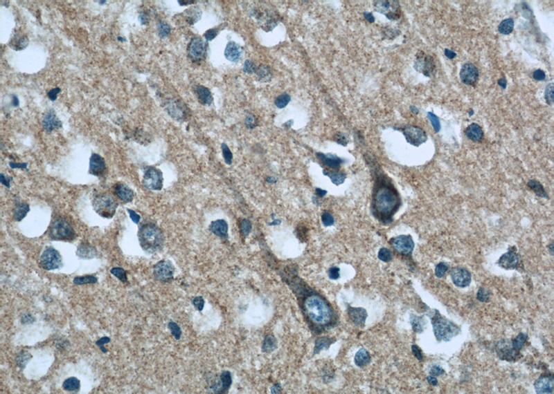 Immunohistochemistry of paraffin-embedded human brain tissue slide using Catalog No:114434(RAB35 Antibody) at dilution of 1:50 (under 40x lens)