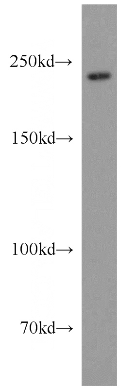 mouse liver tissue were subjected to SDS PAGE followed by western blot with Catalog No:112582(MED12 antibody) at dilution of 1:800