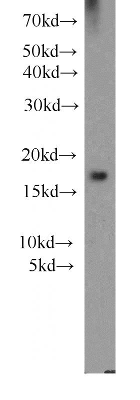 mouse brain tissue were subjected to SDS PAGE followed by western blot with Catalog No:109365(CFL1 antibody) at dilution of 1:1000