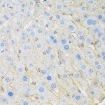 Immunohistochemistry - KIAA1456 Polyclonal Antibody 