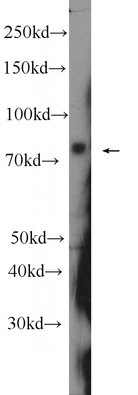 human plasma tissue were subjected to SDS PAGE followed by western blot with Catalog No:111696(IGHM Antibody) at dilution of 1:300