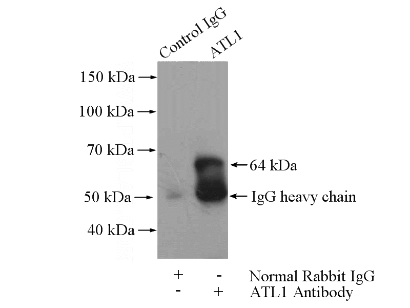 IP Result of anti-ATL1 (IP:Catalog No:108331, 4ug; Detection:Catalog No:108331 1:500) with mouse brain tissue lysate 4000ug.