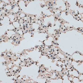 Immunohistochemistry - RBM17 Polyclonal Antibody 