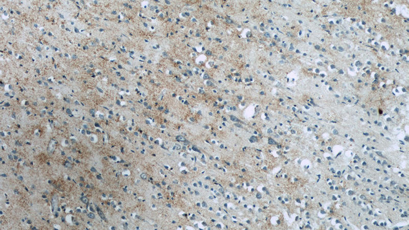 Immunohistochemistry of paraffin-embedded human brain slide using Catalog No:117210(BNP Antibody) at dilution of 1:50