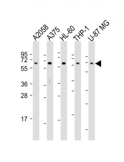 All lanes: Anti-CD63 Antibody (C-term) at 1:2000 dilutionnLane 1: A2058 whole cell lysatesnLane 2: A375 whole cell lysatesnLane 3: HL-60 whole cell lysatesnLane 4: THP-1 whole cell lysatesnLane 5: U-87 MG whole cell lysatesnnLysates/proteins at 20 u03bcg per lane. nnSecondarynGoat Anti-Rabbit IgG,  (H+L), Peroxidase conjugated at 1/10000 dilutionnnPredicted band size: 25 kDannBlocking/Dilution buffer: 5% NFDM/TBST.