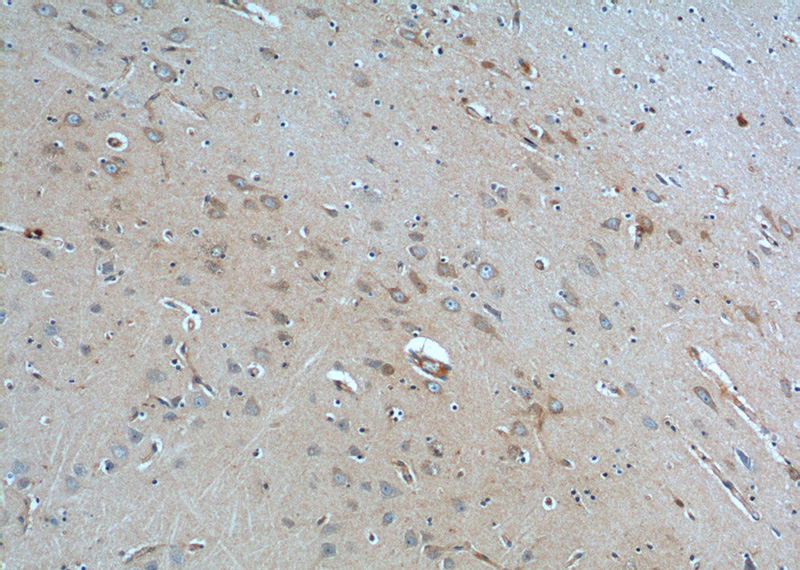 Immunohistochemistry of paraffin-embedded human brain tissue slide using Catalog No:111709(HTR1B Antibody) at dilution of 1:100 (under 10x lens).
