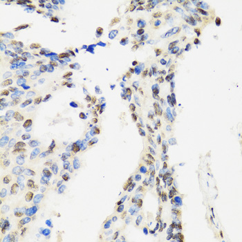 Immunohistochemistry - CCAR2 Polyclonal Antibody 