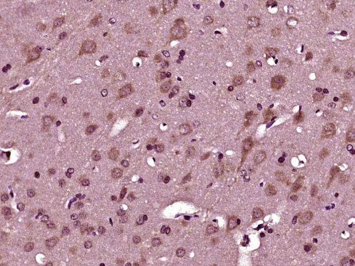 Fig1: Paraformaldehyde-fixed, paraffin embedded (rat brain tissue); Antigen retrieval by boiling in sodium citrate buffer (pH6.0) for 15min; Block endogenous peroxidase by 3% hydrogen peroxide for 20 minutes; Blocking buffer (normal goat serum) at 37℃ for 30min; Antibody incubation with (SEZ6L) Polyclonal Antibody, Unconjugated at 1:400 overnight at 4℃, followed by operating according to SP Kit(Rabbit) (sp-0023) instructionsand DAB staining.