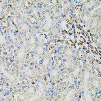 Immunohistochemistry - PSMC3 Polyclonal Antibody 