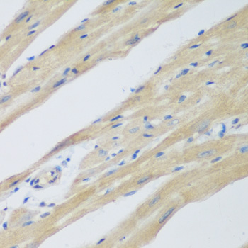 Immunohistochemistry - WDR77 Polyclonal Antibody 