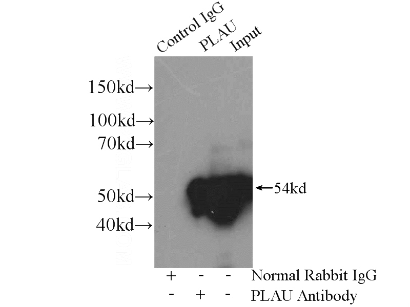 IP Result of anti-uPA (IP:Catalog No:116622, 4ug; Detection:Catalog No:116622 1:1000) with HeLa cells lysate 2800ug.